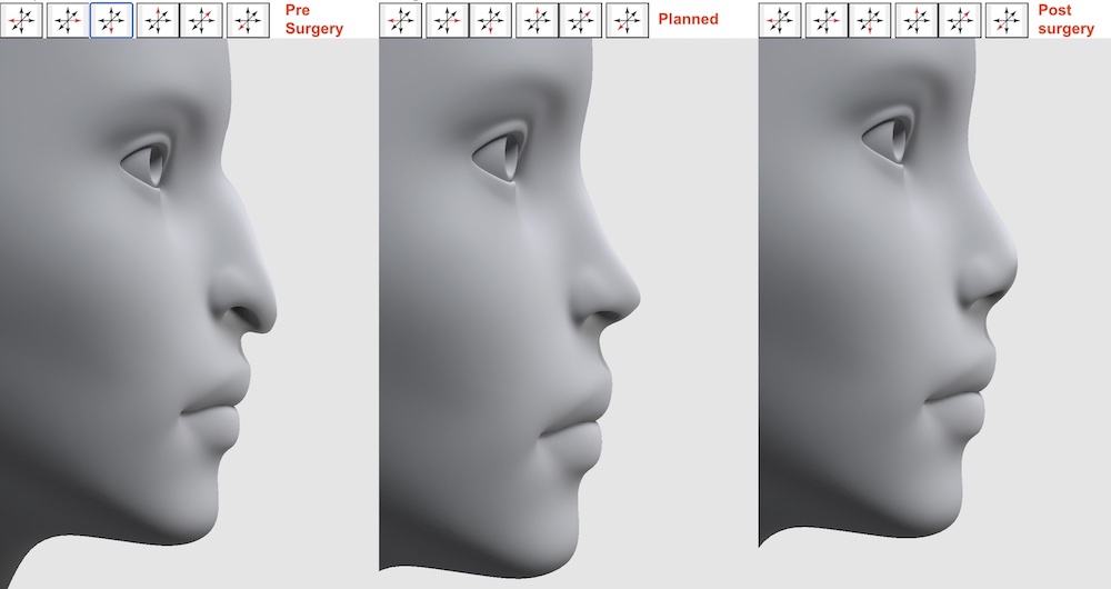 Evaluator for Facial Surgeries